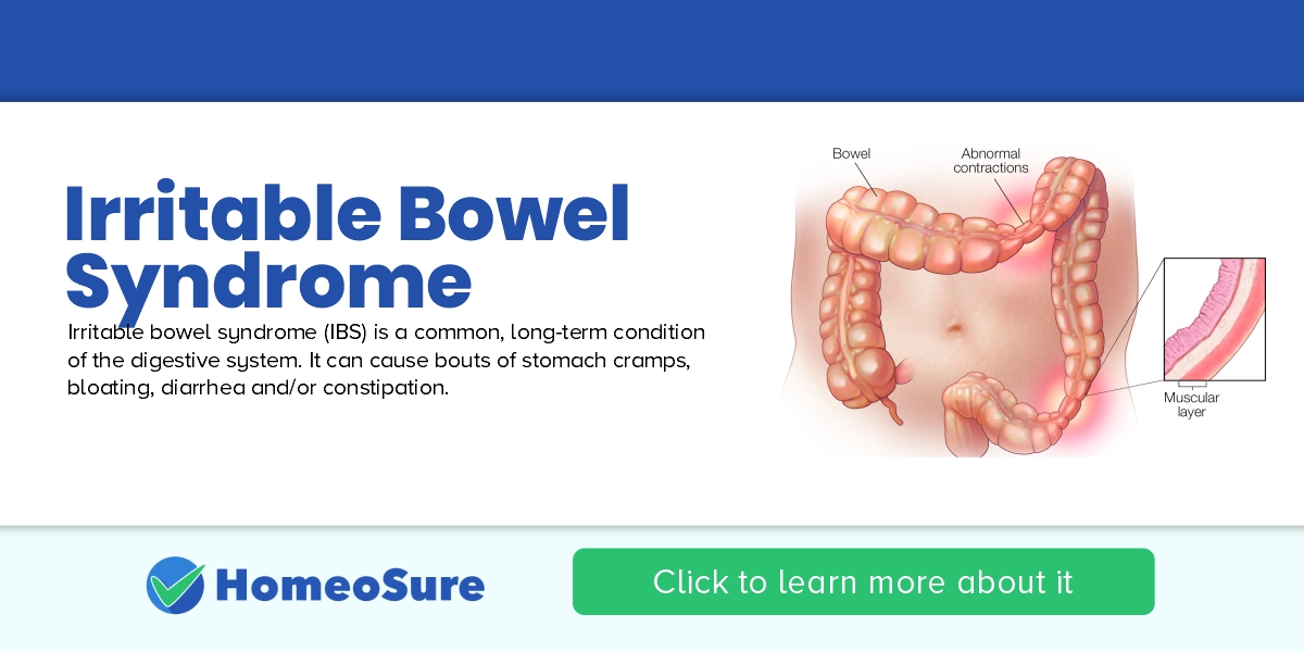 Irritable bowel syndrome (IBS) Treatment